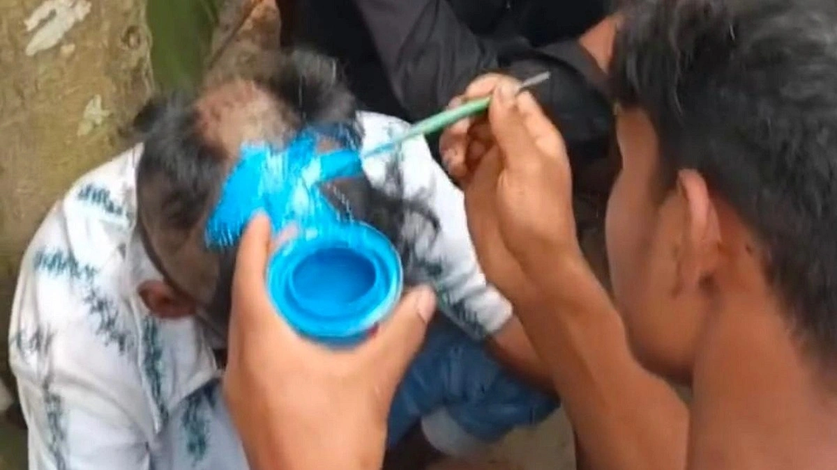 ‘চুরি করায়’ ন্যাড়া মাথায় আঁকা হলো আর্জেন্টিনার পতাকা