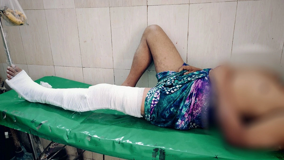 চাঁদা না পেয়ে ব্যবসায়ীর হাত-পা ভেঙে দিলেন শ্রমিকদল নেতা