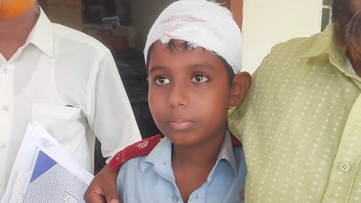 শ্রেণিকক্ষে মাথায় ফ্যান পড়ে শিক্ষার্থী আহত