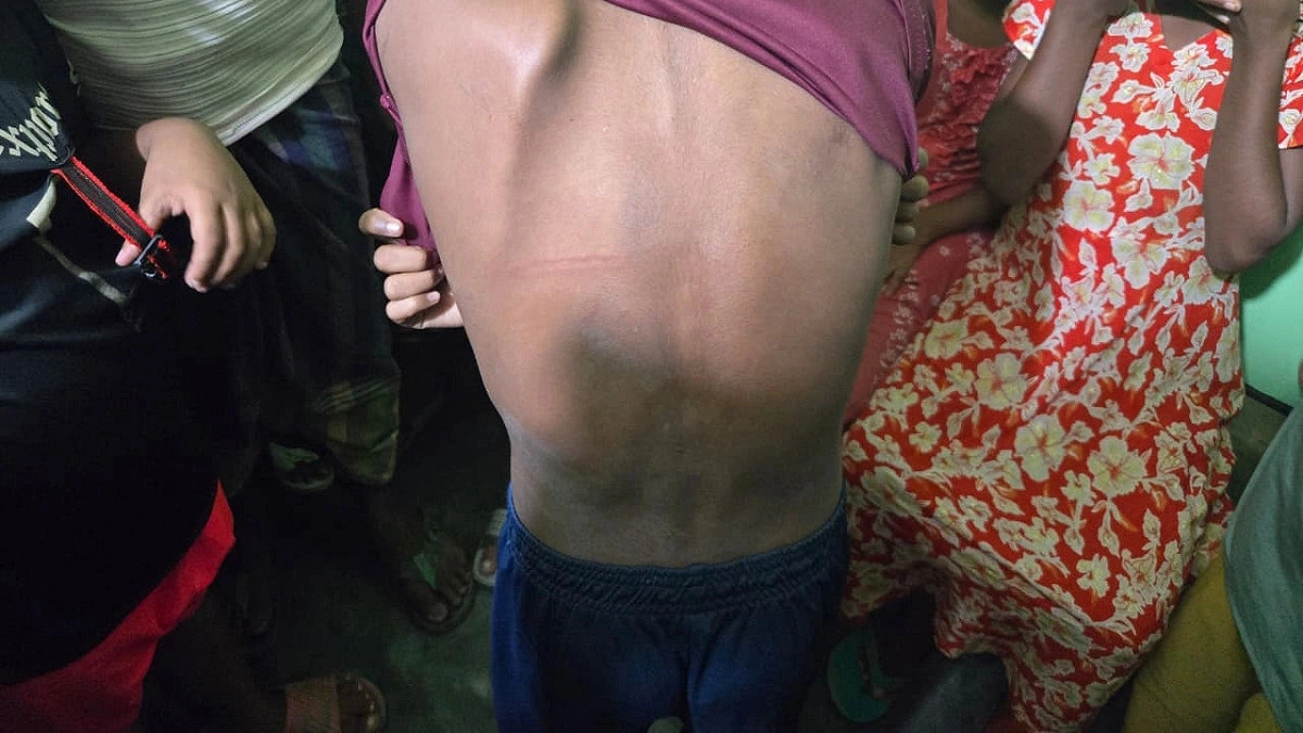 বিদ্যুতের তার দিয়ে শিক্ষার্থীদের পেটালেন স্কুলশিক্ষক