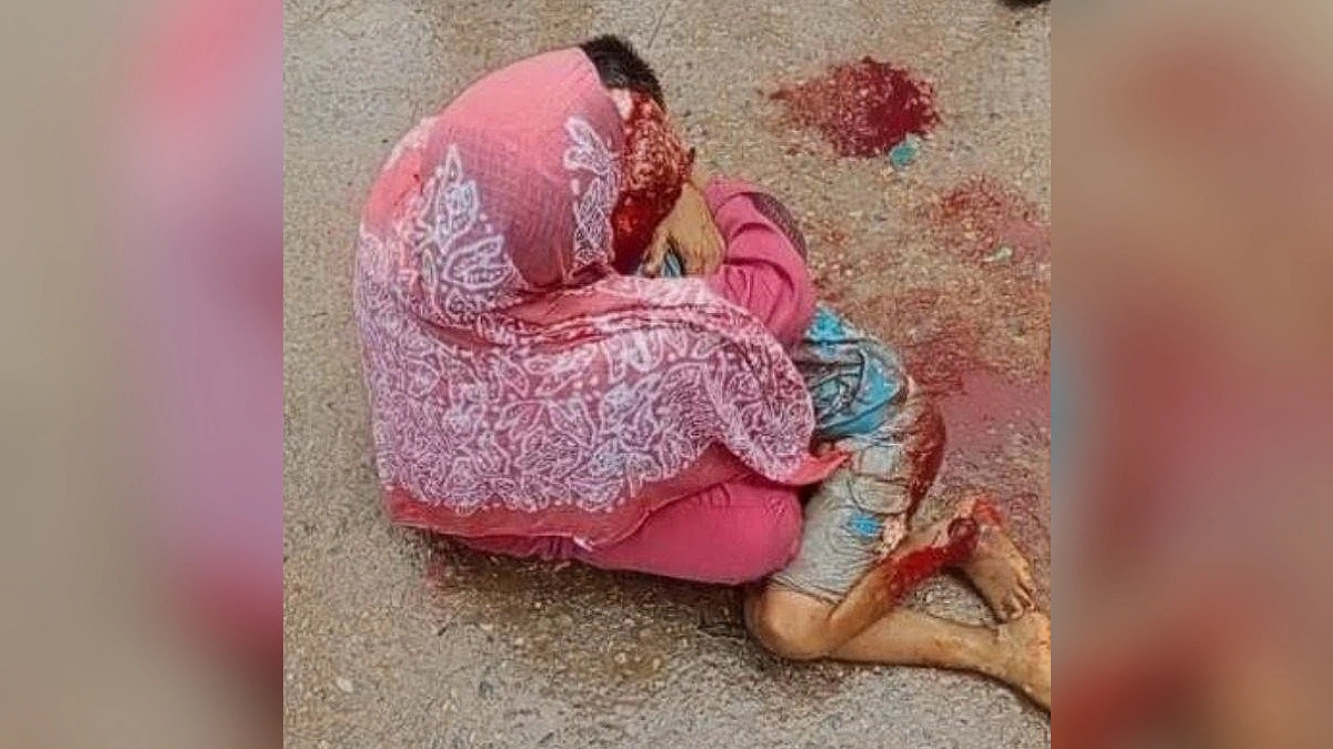 রক্তাক্ত শিশুকে জড়িয়ে ধরে কান্নায় ভেঙে পড়লেন মা