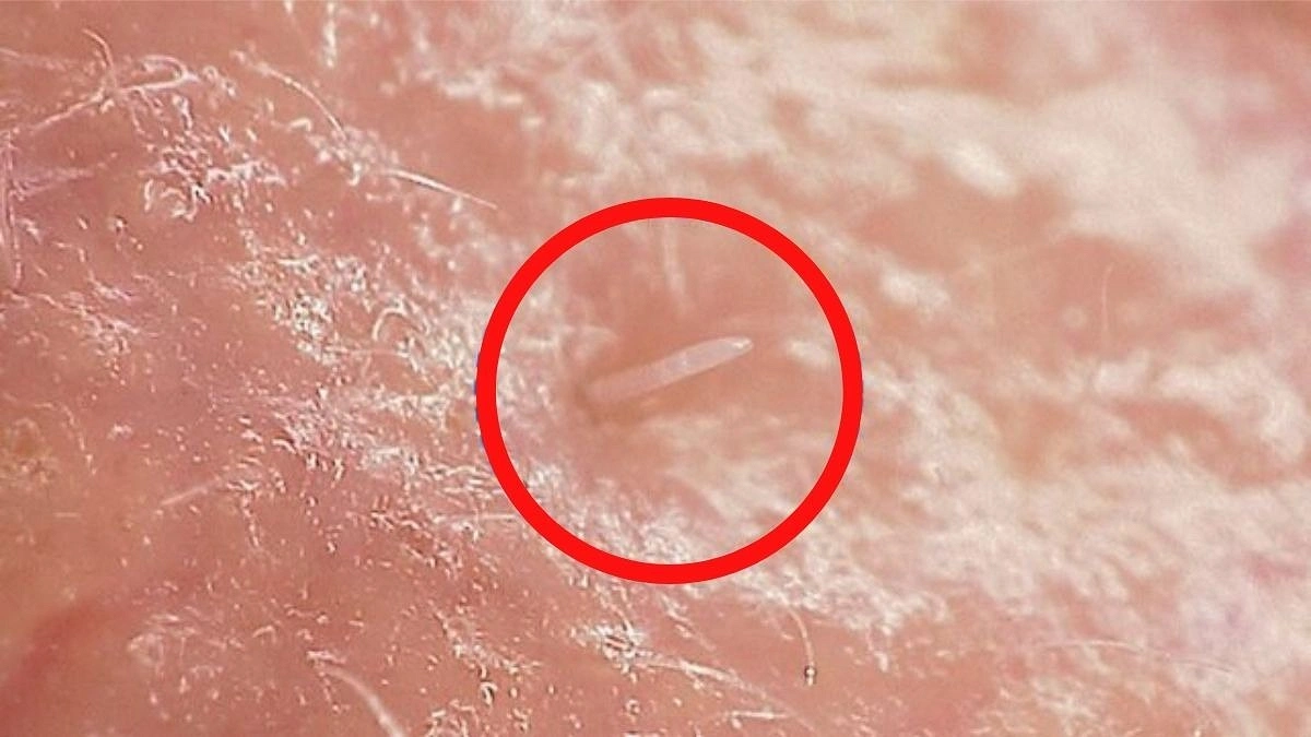মানুষ একা নয়, সব সময় সঙ্গে থাকে যে আজব প্রাণী!