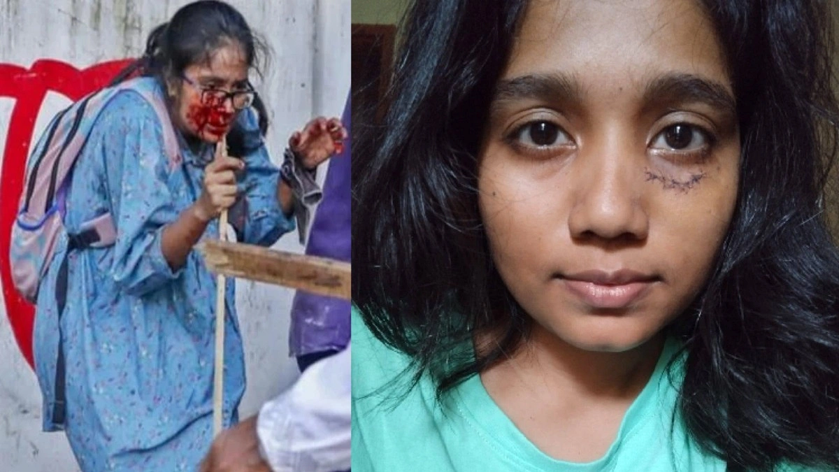 গর্বের সঙ্গে সেই ক্ষত বয়ে বেড়াচ্ছি : তন্বি