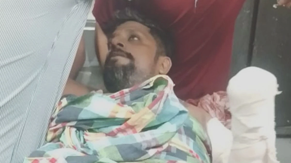 যুবদল নেতাকে কুপিয়ে জখম কবজি বিচ্ছিন্ন