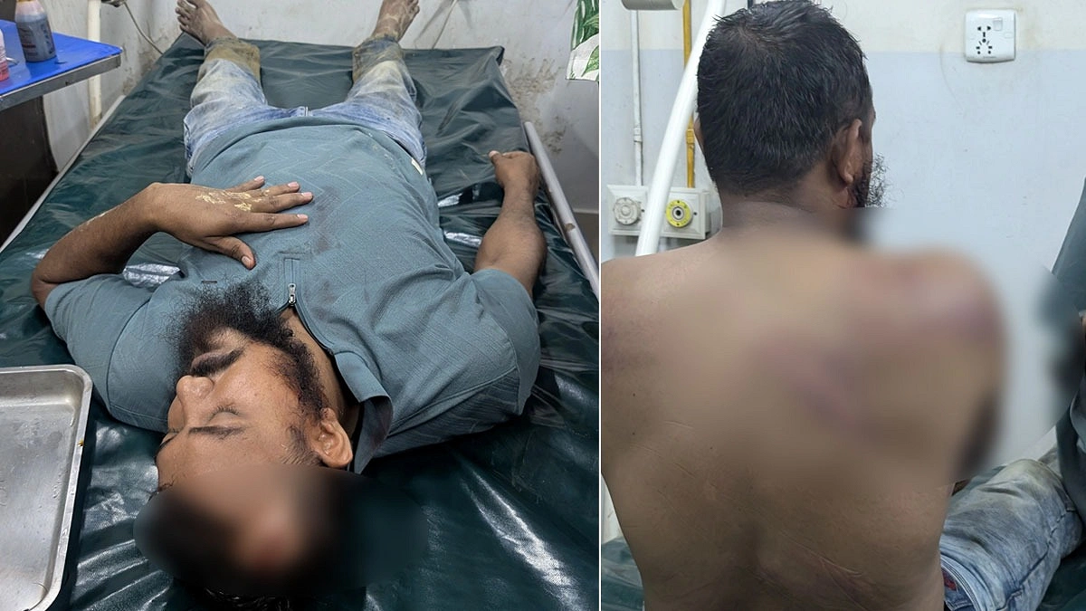 বন বিভাগের অভিযানে হামলা, রেঞ্জ কর্মকর্তাসহ আহত ৫